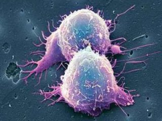 شناخت سلول های بنيادی و نقش آن در درمان سرطان