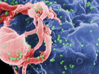 سلول های مهندسی شده برای جستجو و قتل HIV در بافت های زنده