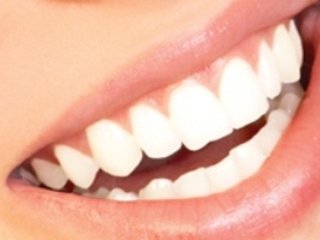 فلورايد باعث كاهش پوسيدگی دندان