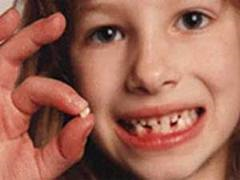 ﻿  چگونه از زود افتادن دندانهاي شيري کودکمان جلوگیری کنیم؟