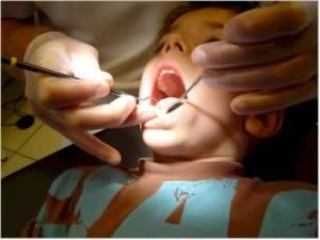 مهم ترين عوامل پوسيدگي دندان در کودکان